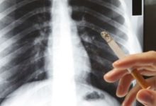Photo of Как курильщики могут избежать рака легких